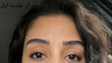 تصویر 